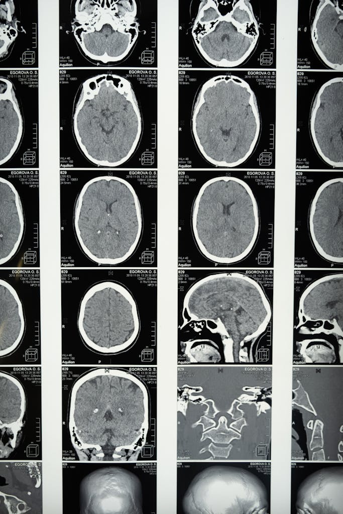 Comprehensive set of brain MRI scans highlighting cranial anatomy for medical use.